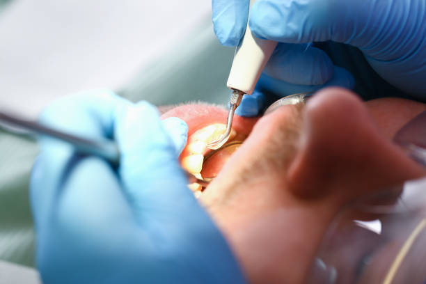 Best Pediatric Emergency Dentist in Hamilton Square, NJ