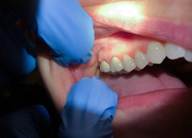 Best Emergency Dental Services for Seniors in Hamilton Square, NJ