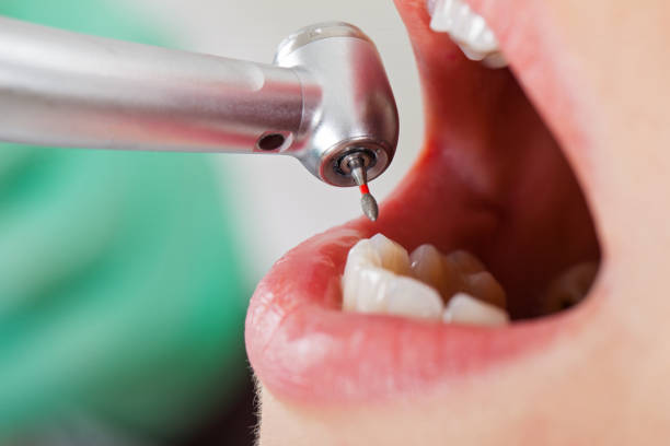 Best Weekend Emergency Dentist in Hamilton Square, NJ